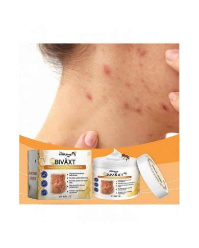 Psoriasis au venin d’abeille Crème apaisante Crème anti-démangeaisons efficace Crème anti-rougeurs Peau Produits [...]