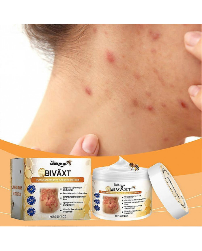 Psoriasis au venin d’abeille Crème apaisante Crème anti-démangeaisons efficace Crème anti-rougeurs Peau Produits [...]