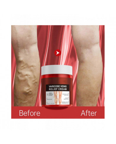 Crème anti-varices, Crème anti-variqueuse, Crème apaisante anti-variqueuse, Crème anti-varices pour les jambes, [...]