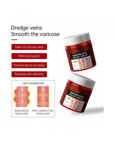 Crème anti-varices, Crème anti-variqueuse, Crème apaisante anti-variqueuse, Crème anti-varices pour les jambes, [...]