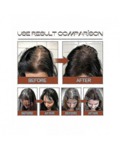 Huile de Batana 100% pure à partir de beurre de Batana naturel pour la croissance des cheveux Traitement de [...]