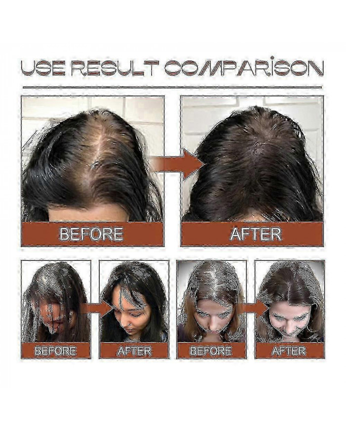 Huile de Batana 100% pure à partir de beurre de Batana naturel pour la croissance des cheveux Traitement de [...]