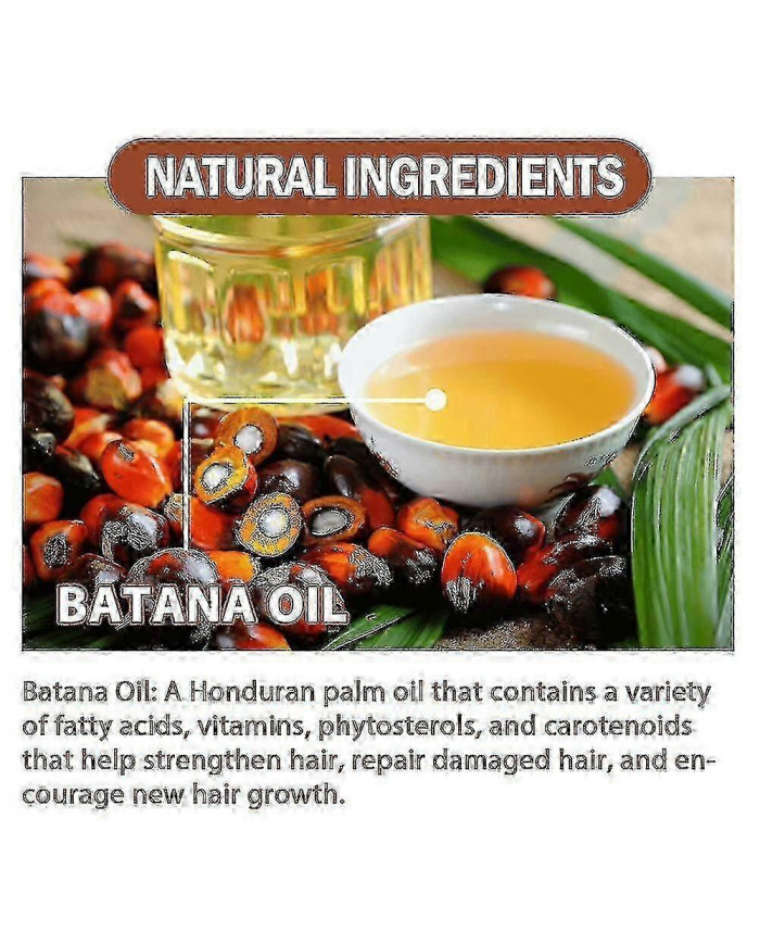Huile de Batana 100% pure à partir de beurre de Batana naturel pour la croissance des cheveux Traitement de [...]