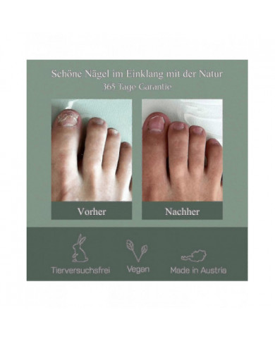 2024 -Stylo de soin des ongles, Expériences autrichiennes de champignon des ongles, Expériences de stylo de soins [...]