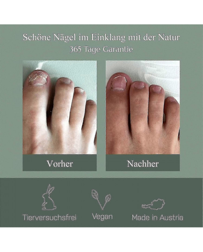 2024 -Stylo de soin des ongles, Expériences autrichiennes de champignon des ongles, Expériences de stylo de soins [...]