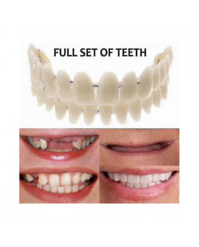 Prothèses dentaires supérieures inférieures - Snap On Fausses dents pour un sourire parfait