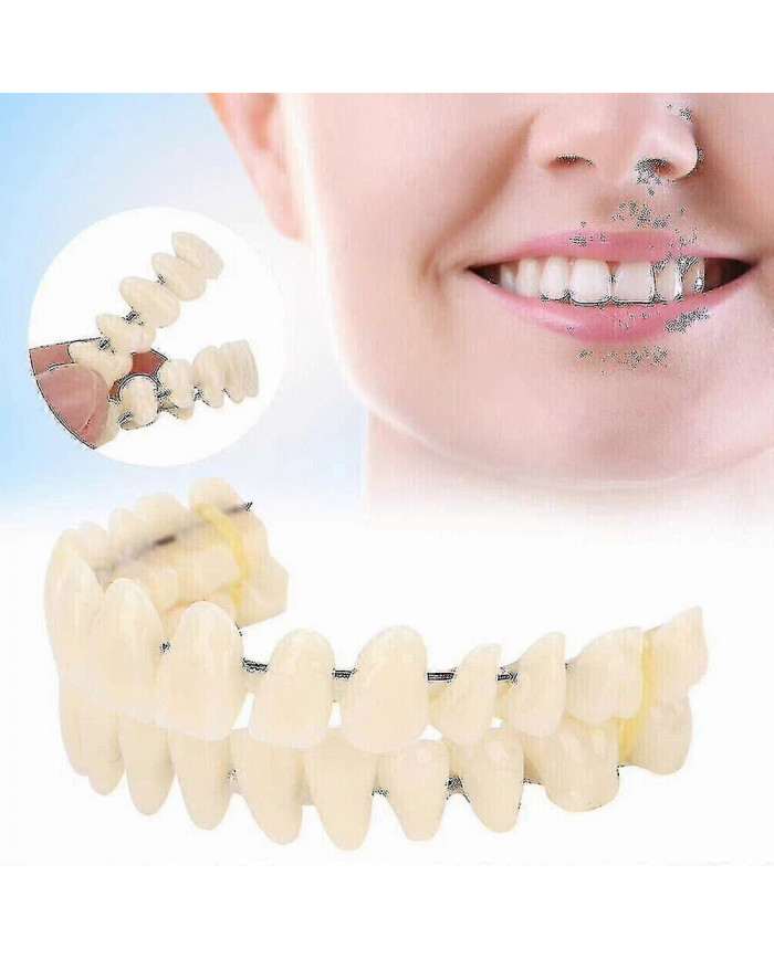 Prothèses dentaires supérieures inférieures - Snap On Fausses dents pour un sourire parfait