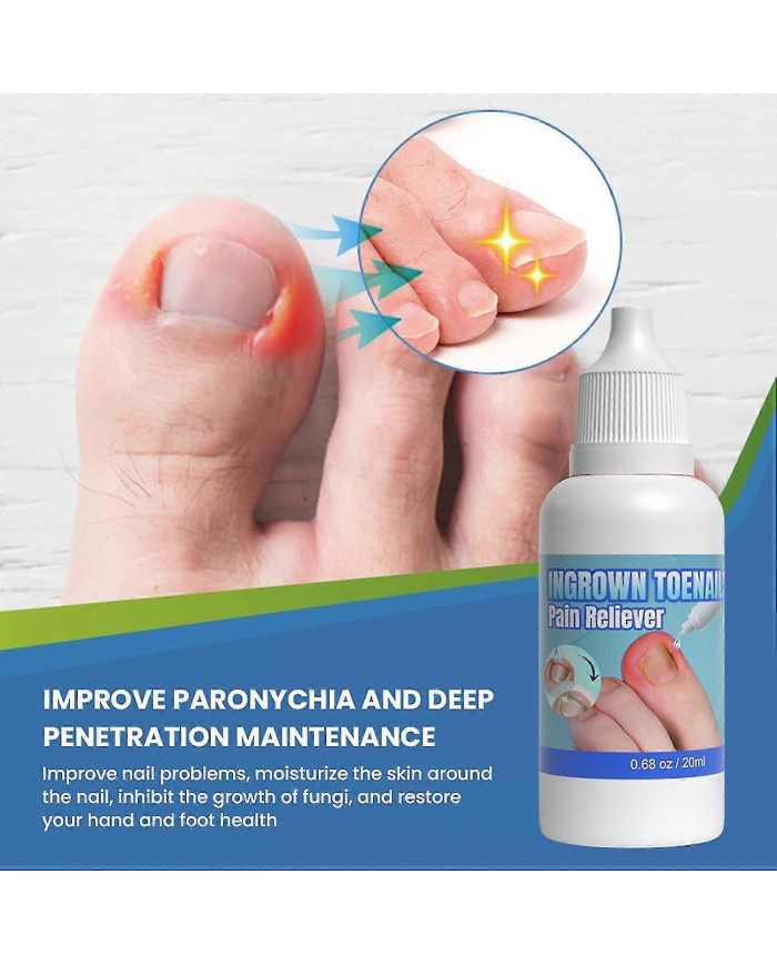 Traitement des ongles incarnés extra fort, 20 ml de goutte pour ongles incarnés, huile de soin des cuticules pour [...]