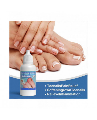 Traitement des ongles incarnés extra fort, 20 ml de goutte pour ongles incarnés, huile de soin des cuticules pour [...]