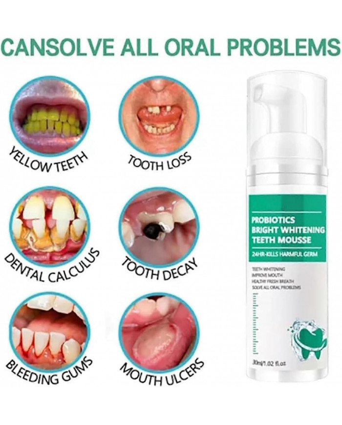 1-3Pcs Lenaro Probiotiques Brillant Blanchiment Dents Mousse, Lenaro Oral Repair Mousse