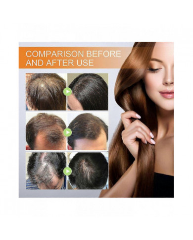 2x Huile de pépins de citrouille pour la croissance des cheveux L’huile de citrouille pour la croissance des [...]