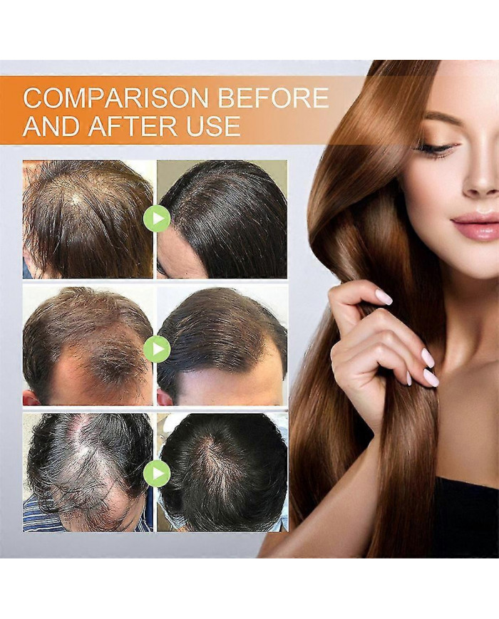 2x Huile de pépins de citrouille pour la croissance des cheveux L’huile de citrouille pour la croissance des [...]