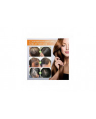 2x Huile de pépins de citrouille pour la croissance des cheveux L’huile de citrouille pour la croissance des [...]