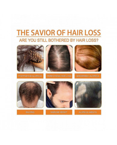 2x Huile de pépins de citrouille pour la croissance des cheveux L’huile de citrouille pour la croissance des [...]