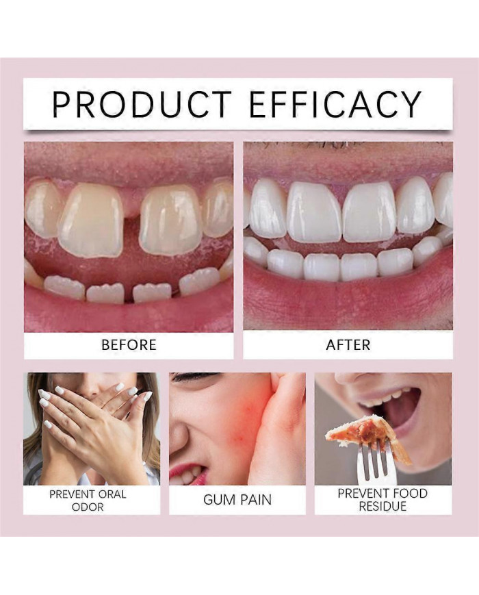 Adhésif pour prothèses dentaires, adhésif pour prothèses dentaires thermoplastique, prise en main confortable et [...]