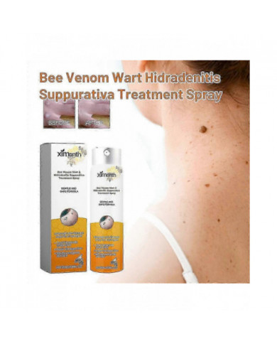 Venin d’abeille pour les verrues et les papillomes