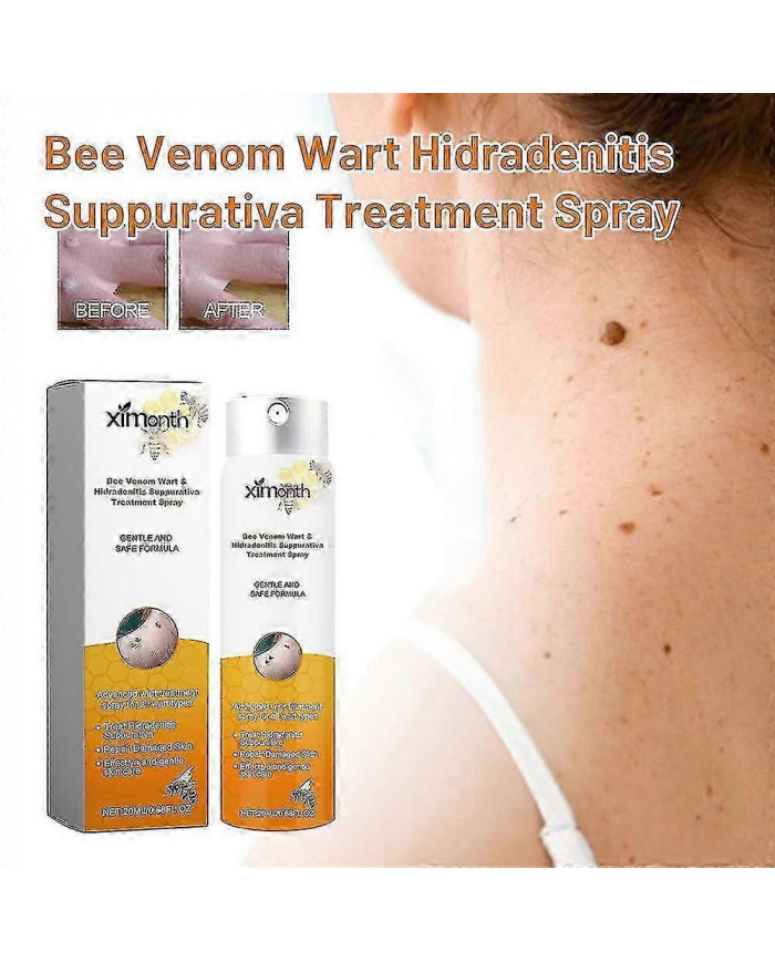 Venin d’abeille pour les verrues et les papillomes