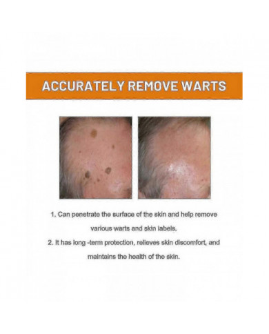 Venin d’abeille pour les verrues et les papillomes