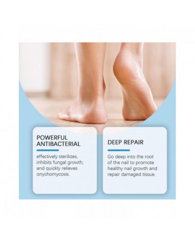 Traitement antifongique des ongles de 7 jours, 30 ml de sérum de croissance et de renforcement des ongles de [...]