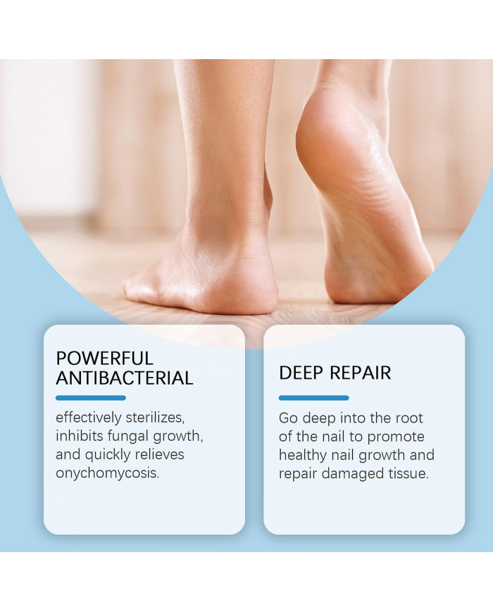 Traitement antifongique des ongles de 7 jours, 30 ml de sérum de croissance et de renforcement des ongles de [...]