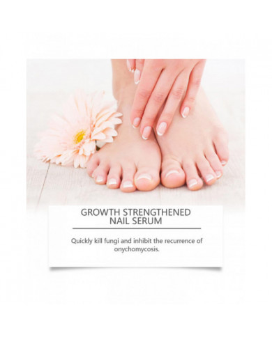 Traitement antifongique des ongles de 7 jours, 30 ml de sérum de croissance et de renforcement des ongles de [...]
