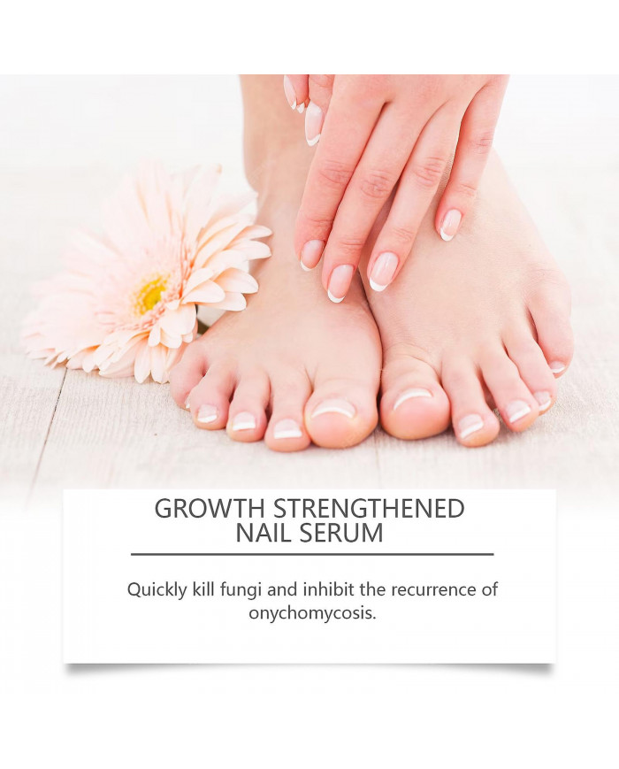 Traitement antifongique des ongles de 7 jours, 30 ml de sérum de croissance et de renforcement des ongles de [...]