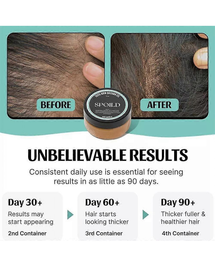 3x Huile de Batana brute pour la croissance des cheveux Huile de Batana 100% pure et naturelle pour traiter la [...]