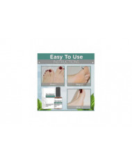 Puissant Pied Corn Remover Utile Foot Callus Remover Extra Strengthen Gel Verrues Nouveau