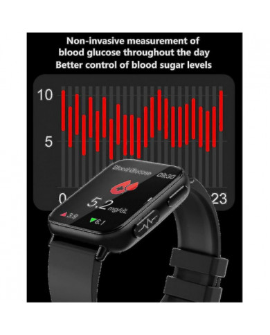 2023 Nouvelle Glycémie Smartwatch Hommes 1,91 Pouces 365 * 400 Hd Écran Ecg + ppg Montre Intelligente Surveillance [...]