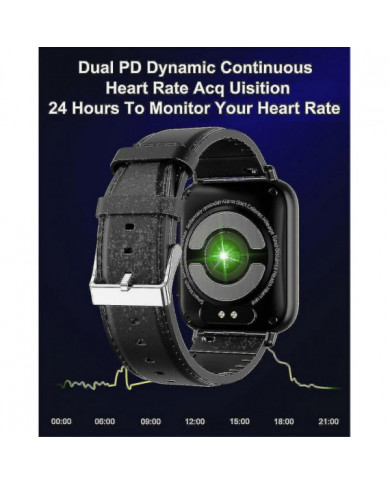 2023 Nouvelle Glycémie Smartwatch Hommes 1,91 Pouces 365 * 400 Hd Écran Ecg + ppg Montre Intelligente Surveillance [...]