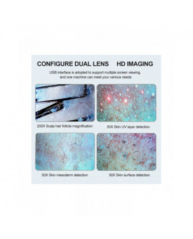 11 pouces Lcd écran peau cheveux cuir chevelu détecteur follicule pileux détecteur grossissant 200x test de microscope