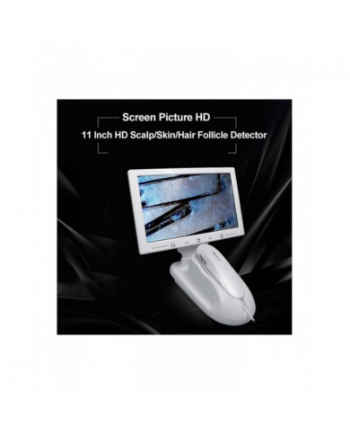 11 pouces Lcd écran peau cheveux cuir chevelu détecteur follicule pileux détecteur grossissant 200x test de microscope