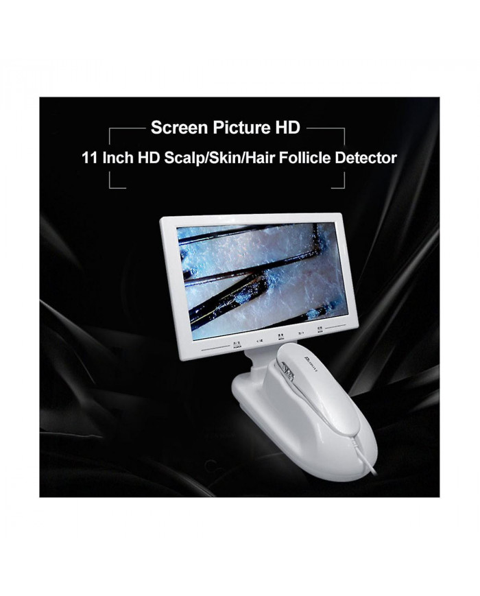 11 pouces Lcd écran peau cheveux cuir chevelu détecteur follicule pileux détecteur grossissant 200x test de microscope