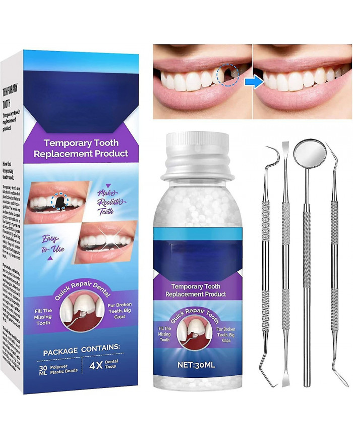 Kit de réparation dentaire, kit de remplacement temporaire des dents, réparation des remplacements de dents [...]