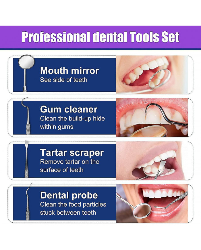 Kit de réparation dentaire, kit de remplacement temporaire des dents, réparation des remplacements de dents [...]