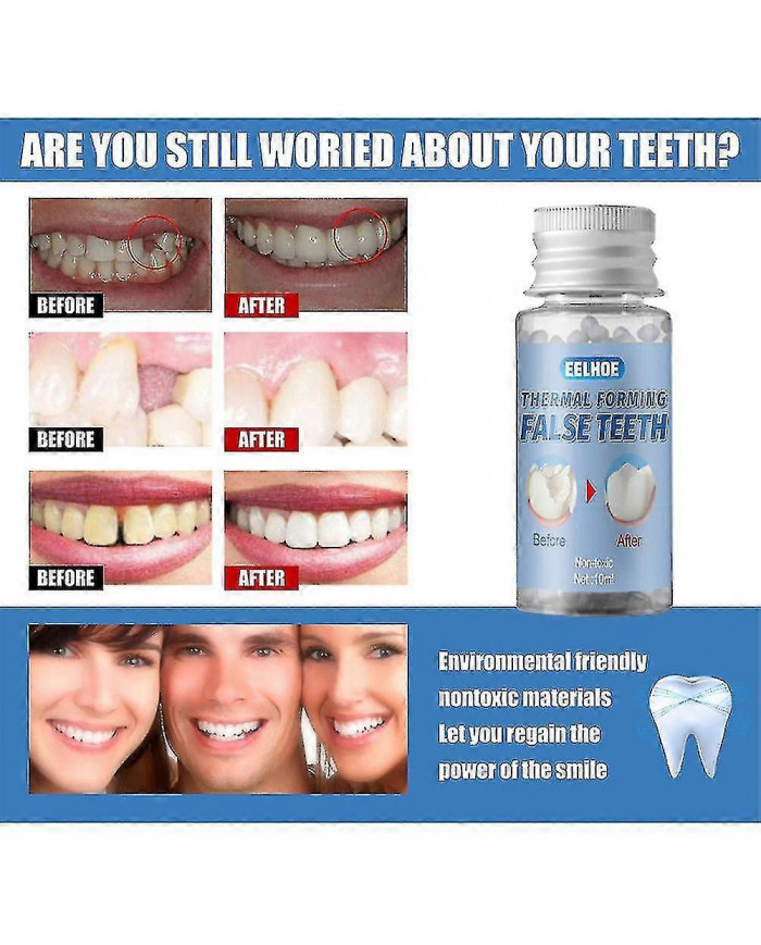 Strong Teeth Repair Kit temporaire de remplissage de cavité de ciment dentaire