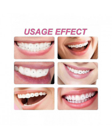 Kit de gemme de dent, kit de bijoux de dent de bricolage, ornements dentaires amovibles, ornements de dents en [...]