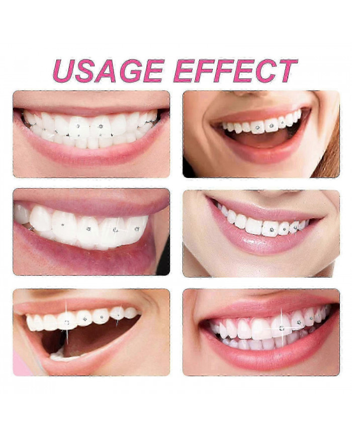 Kit de gemme de dent, kit de bijoux de dent de bricolage, ornements dentaires amovibles, ornements de dents en [...]