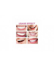 Kit de gemme de dent, kit de bijoux de dent de bricolage, ornements dentaires amovibles, ornements de dents en [...]