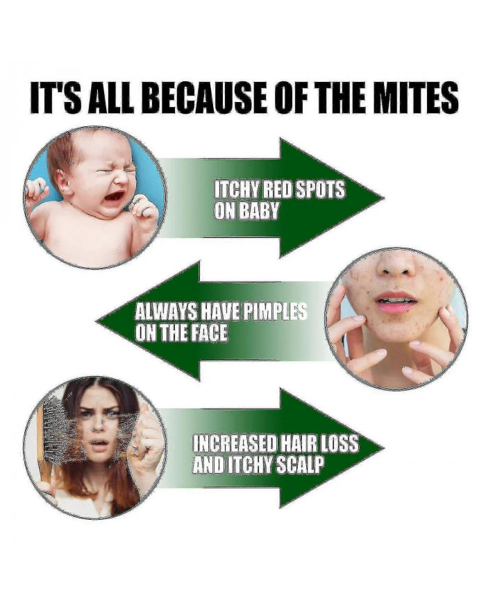 Traitement naturel par pulvérisation de tueur de punaises de lit et d’acariens pour matelas, couettes, tapis et meubles