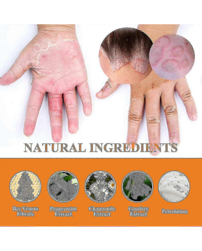 Gel de traitement au venin d’abeille à usage professionnel - 1-10pcsn