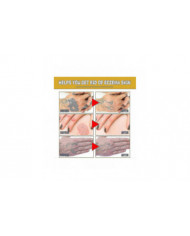 Gel de traitement au venin d’abeille à usage professionnel - 1-10pcsn