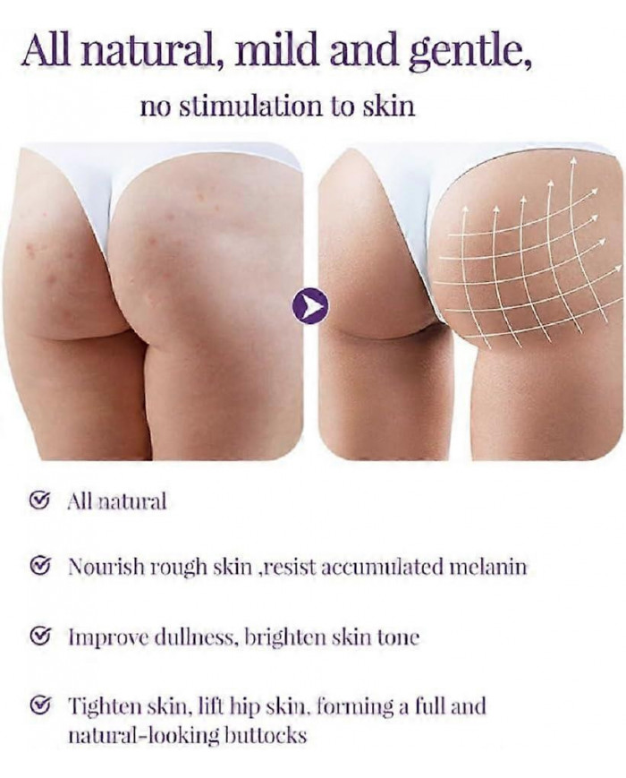 Crème anti-acné fessier, Crème hydratante lissante hanches, Crème éclaircissante fesses et cuisses, Crème [...]