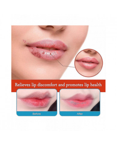 20g Baume à lèvres Crème de traitement de la chéilite Enlever l’huile foncée Hydratant les lèvres Réparateur Anti- [...]