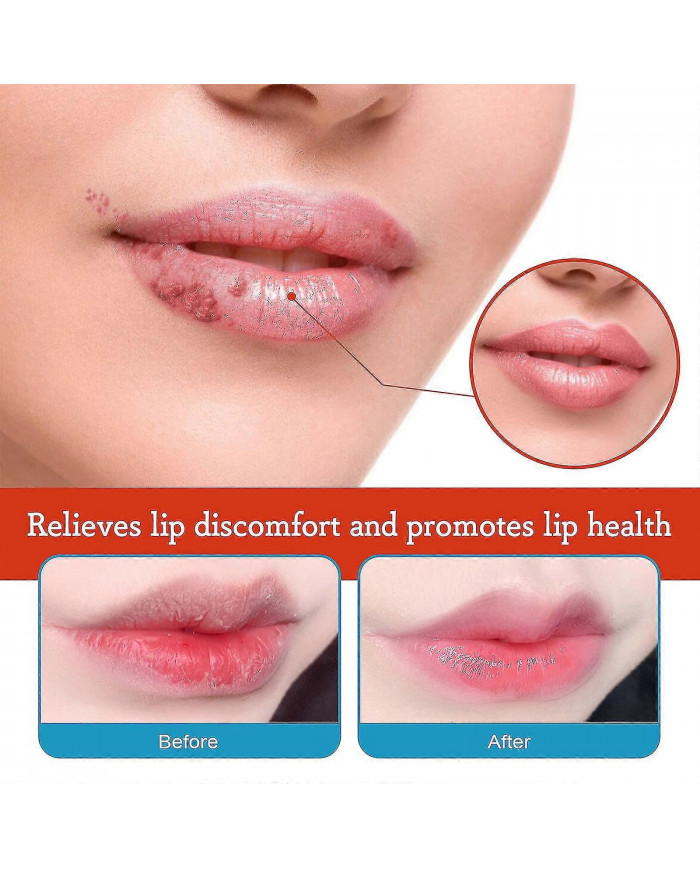 20g Baume à lèvres Crème de traitement de la chéilite Enlever l’huile foncée Hydratant les lèvres Réparateur Anti- [...]