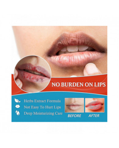 20g Baume à lèvres Crème de traitement de la chéilite Enlever l’huile foncée Hydratant les lèvres Réparateur Anti- [...]