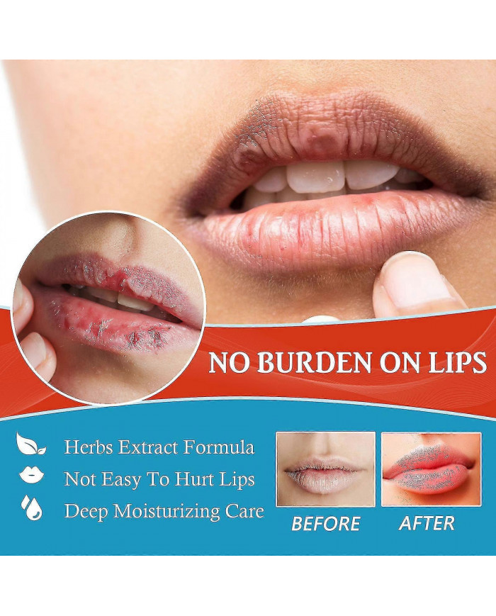 20g Baume à lèvres Crème de traitement de la chéilite Enlever l’huile foncée Hydratant les lèvres Réparateur Anti- [...]