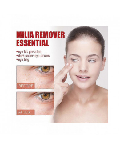 Milia Remover Sérum Essentiel pour les Yeux Efficace Élimine les granules de graisse Poches sous les yeux Anti- [...]