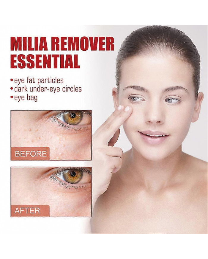 Milia Remover Sérum Essentiel pour les Yeux Efficace Élimine les granules de graisse Poches sous les yeux Anti- [...]