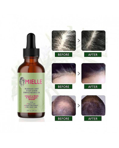 Huile essentielle de croissance des cheveux Romarin Menthe Huile fortifiante pour les cheveux Traitement [...]